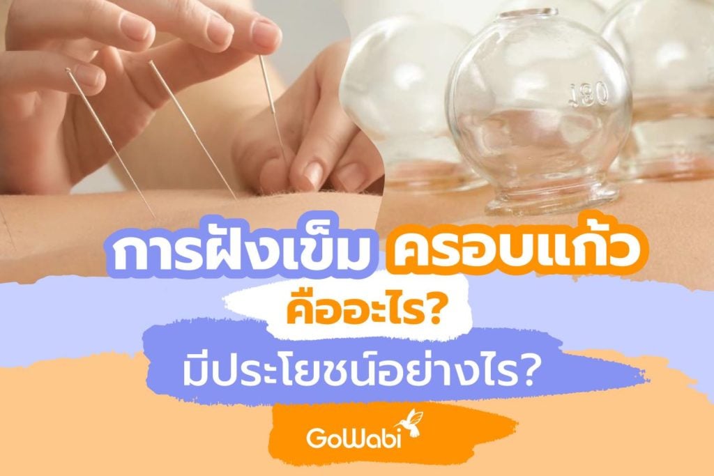 การฝังเข็ม-ครอบแก้ว-คืออะไร-มีประโยชน์อย่างไร