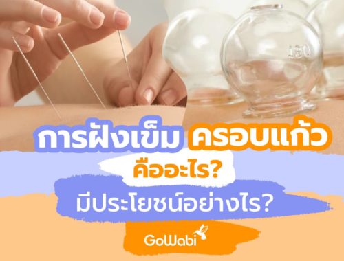การฝังเข็ม-ครอบแก้ว-คืออะไร-มีประโยชน์อย่างไร