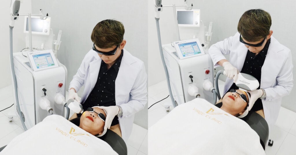 VIRGO CLINIC - [REVIEW] FACIAL IPL โชว์หน้าใสอย่างมั่นใจไร้สิว!