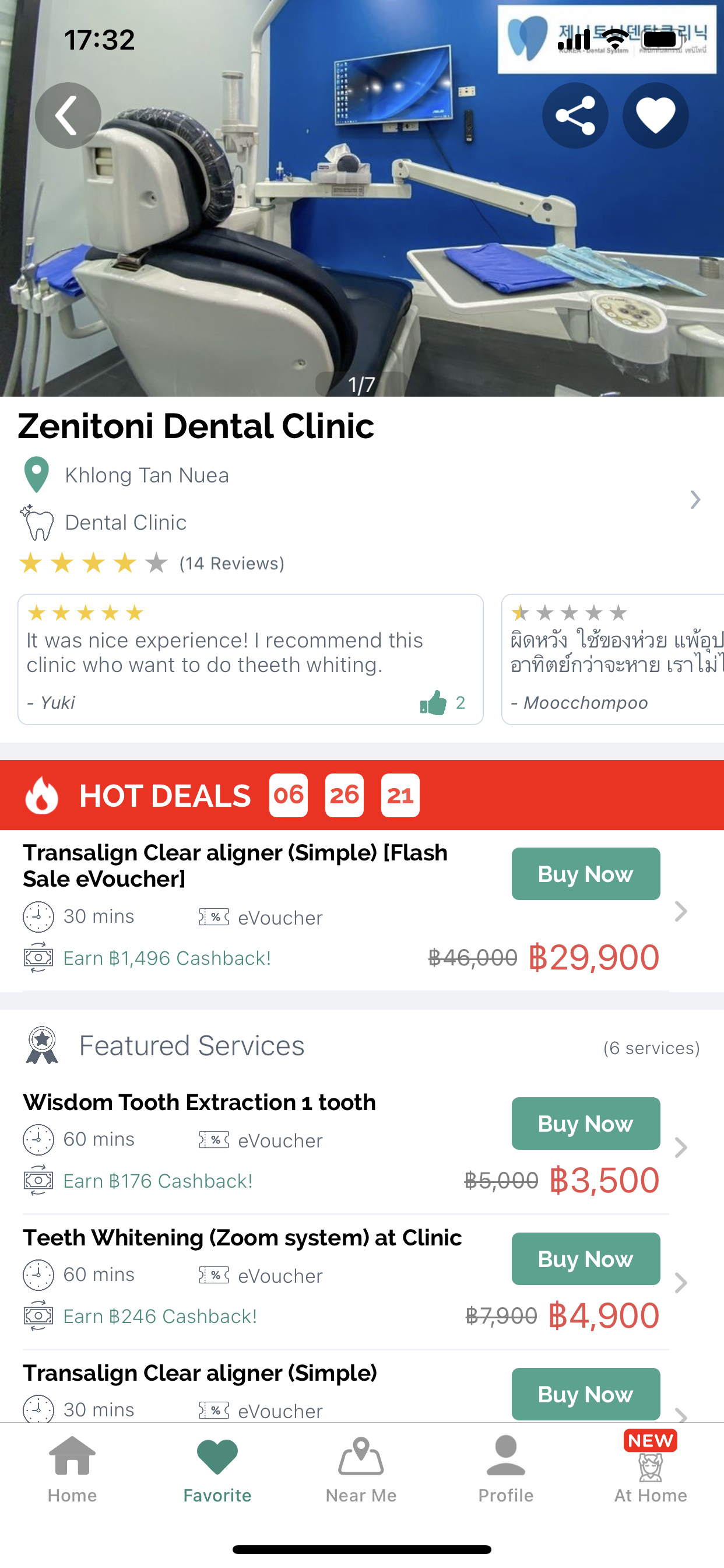 Zenitoni Clinic - [REVIEW] ฟอกฟันขาวด้วยเทคนิค Zoom Whitening