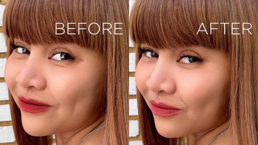 Chercharm Clinic– [REVIEW] รีวิว Botox Wrinkle ฉีดโบท็อกซ์ครั้งแรก จัดการตีนกาอยู่หมัด!