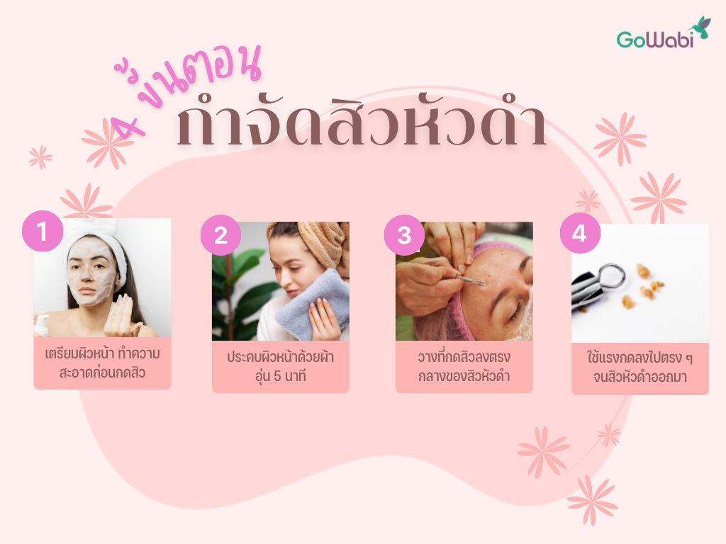 กดสิวหัวดำ
