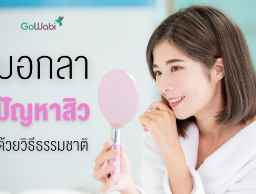 รักษาสิวให้หายขาดแบบธรรมชาติ