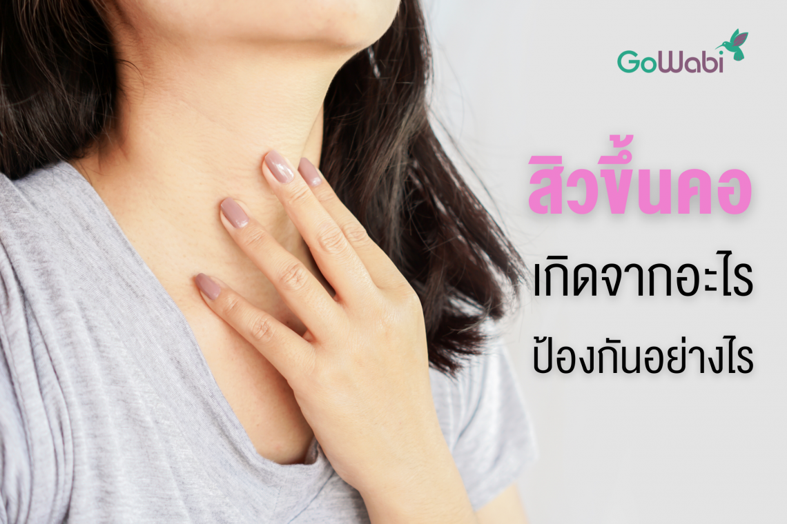 สิวขึ้นคอ