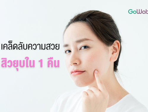 สิวยุบใน 1 คืน