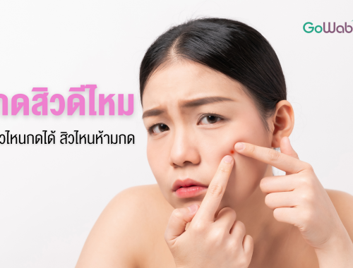 กดสิวดีไหม