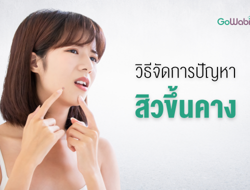 สิวขึ้นคาง