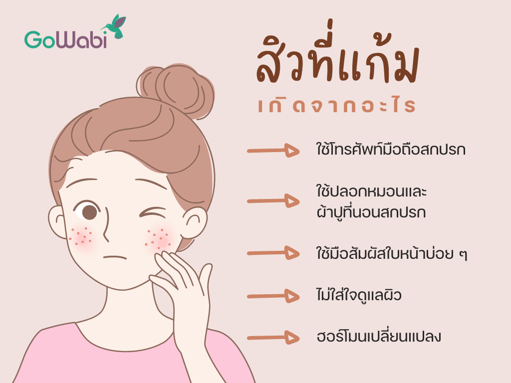 ทำไมสิวขึ้นแก้ม