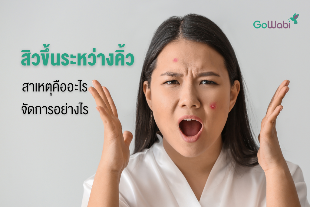 สิวขึ้นระหว่างคิ้ว