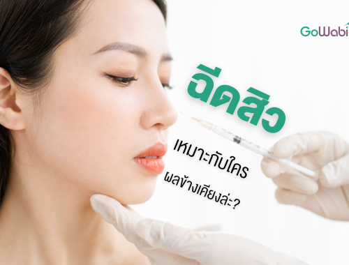 ฉีดสิวดีไหม