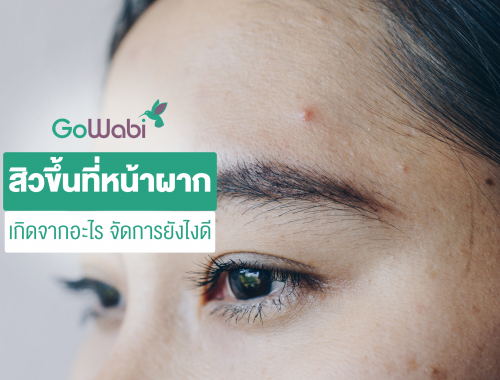 ทำไมสิวขึ้นหน้าผาก