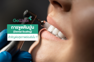 การขูดหินปูน (Dental Scaling) สำคัญต่อสุขภาพช่องยังไง ?