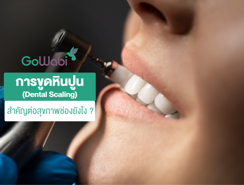 การขูดหินปูน (Dental Scaling) สำคัญต่อสุขภาพช่องยังไง ?