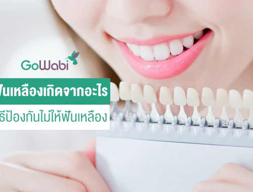 ฟันเหลืองเกิดจากอะไร