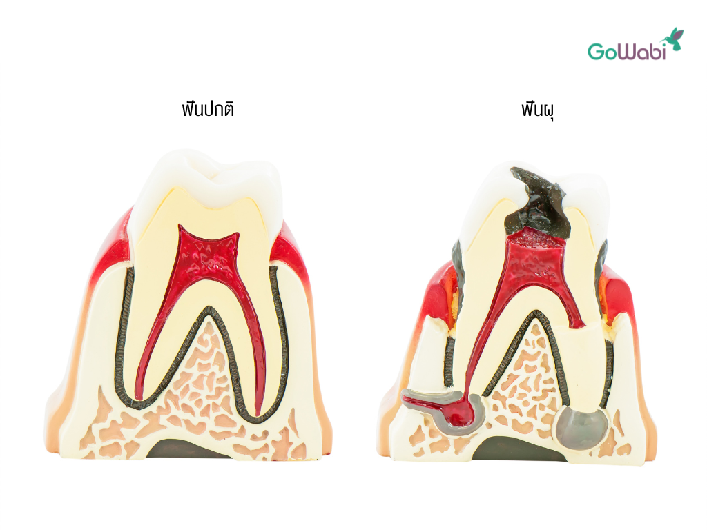 โครงสร้างฟัน