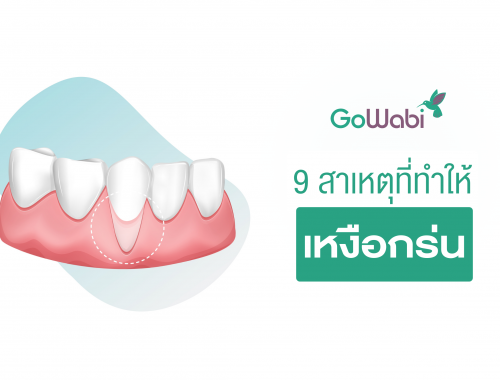 เหงือกร่น เกิดจาก