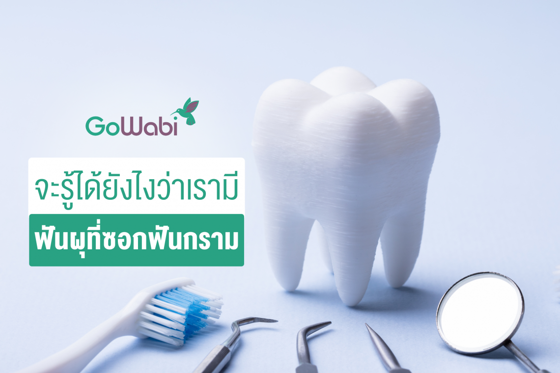 ฟันผุซอกฟันกราม