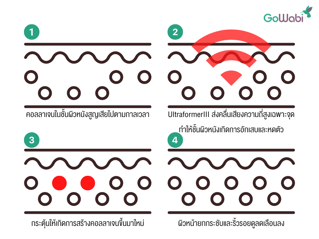 หลักการทำงาน UltraformerIII