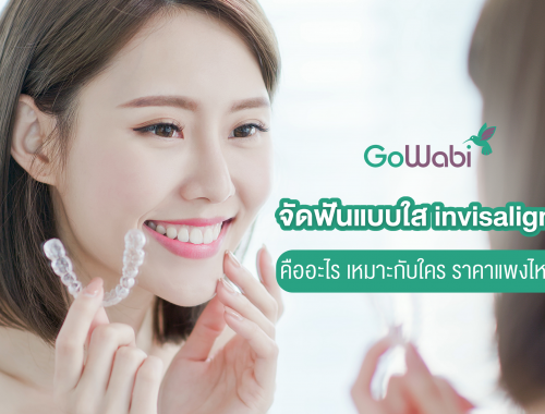 จัดฟันแบบใส
