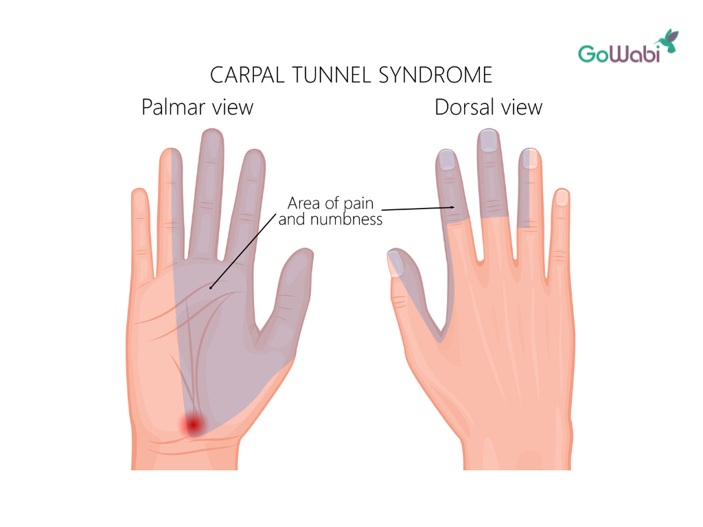 ต้องระวัง! 6 สาเหตุที่ทำให้เกิดอาการชาปลายนิ้วมือ - Gowabi