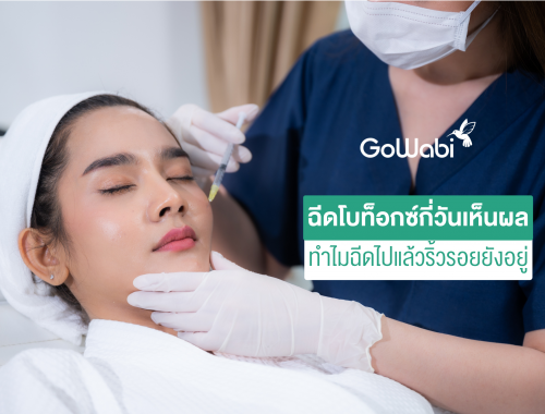 ฉีดโบท็อกซ์กี่วันเห็นผล
