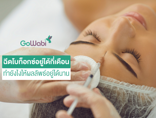 ฉีดโบท็อกซ์อยู่ได้นานกี่เดือน