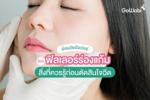 ฟิลเลอร์ร่องแก้ม