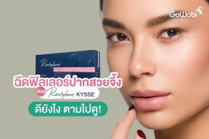 ฟิลเลอร์ปาก restylane kysse