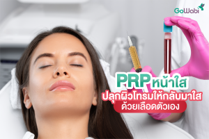 PRP หน้าใสคืออะไร