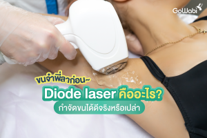 Diode laser คือ