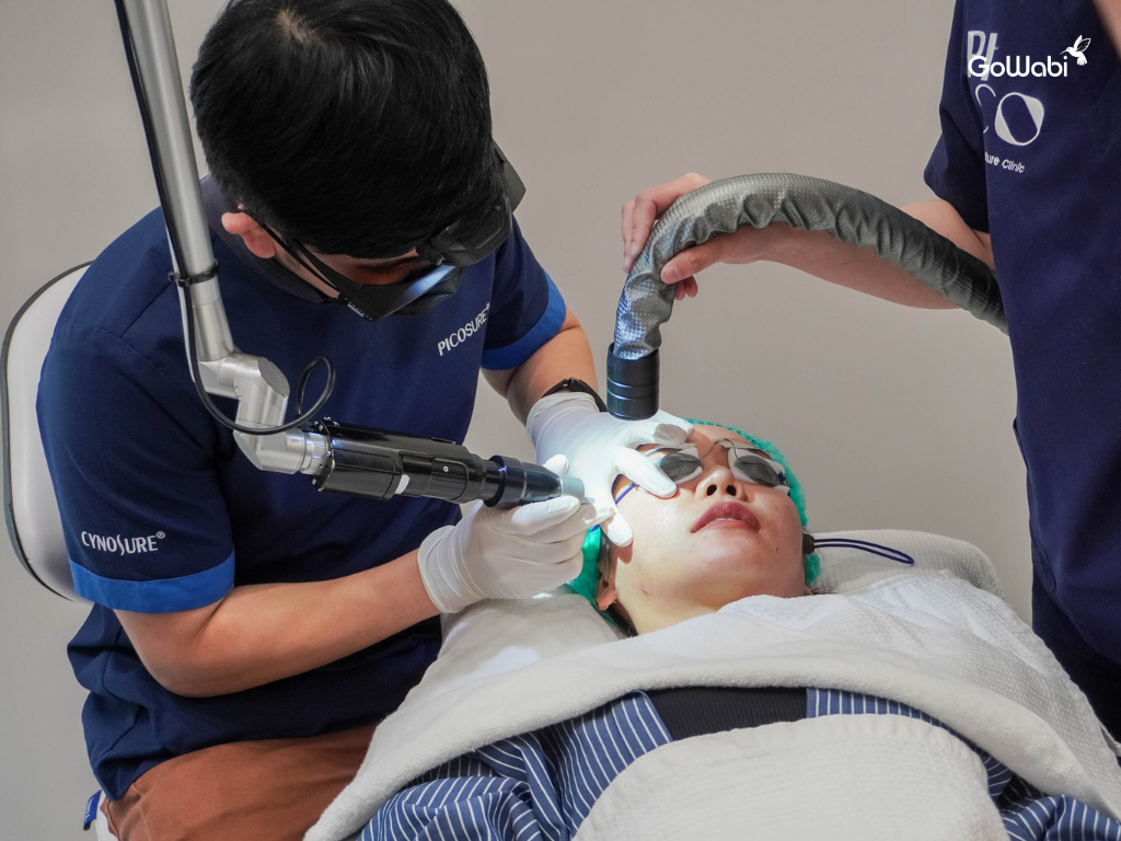 pico laser รีวิวระหว่างทำ