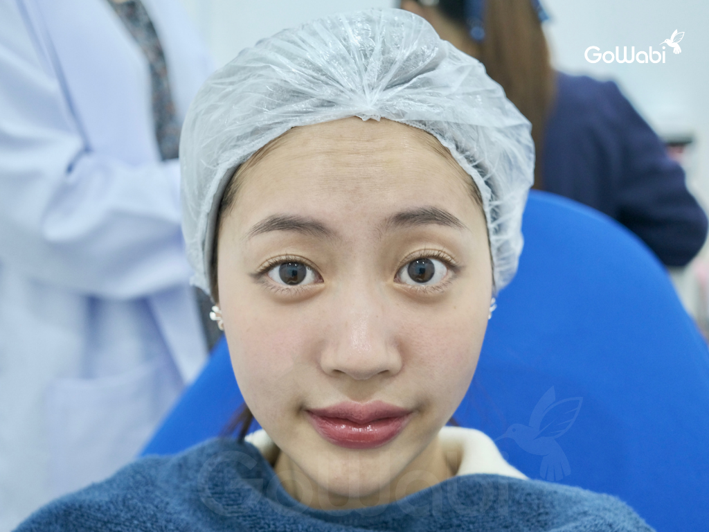 รีวิว Arix clinic ฉีดนาโบตะก่อนฉีด