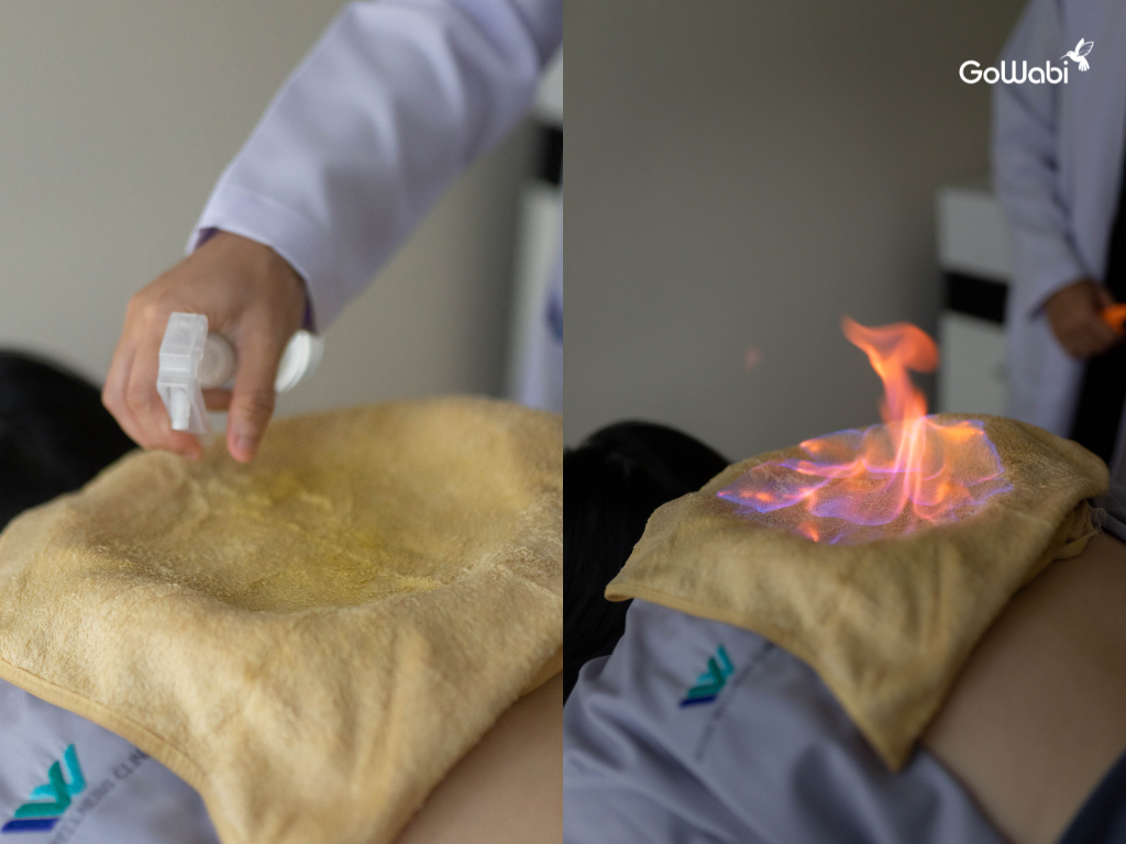 inter wellness clinic รีวิว การเผายา