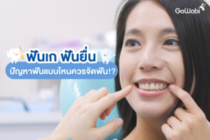 ฟันแบบไหนควรจัดฟัน