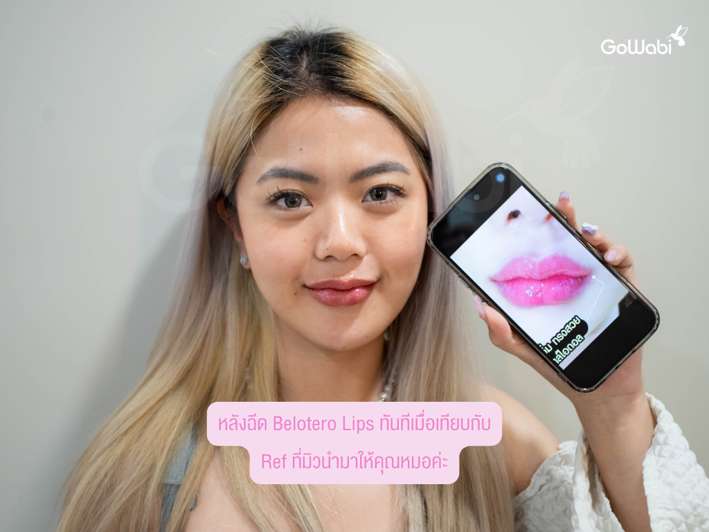 Matrix clinic รีวิวหลังทำเมื่อเทียบกับเรฟ