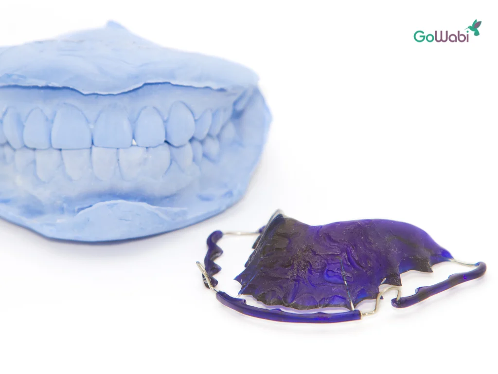 สีรีเทนเนอร์วันจันทร์