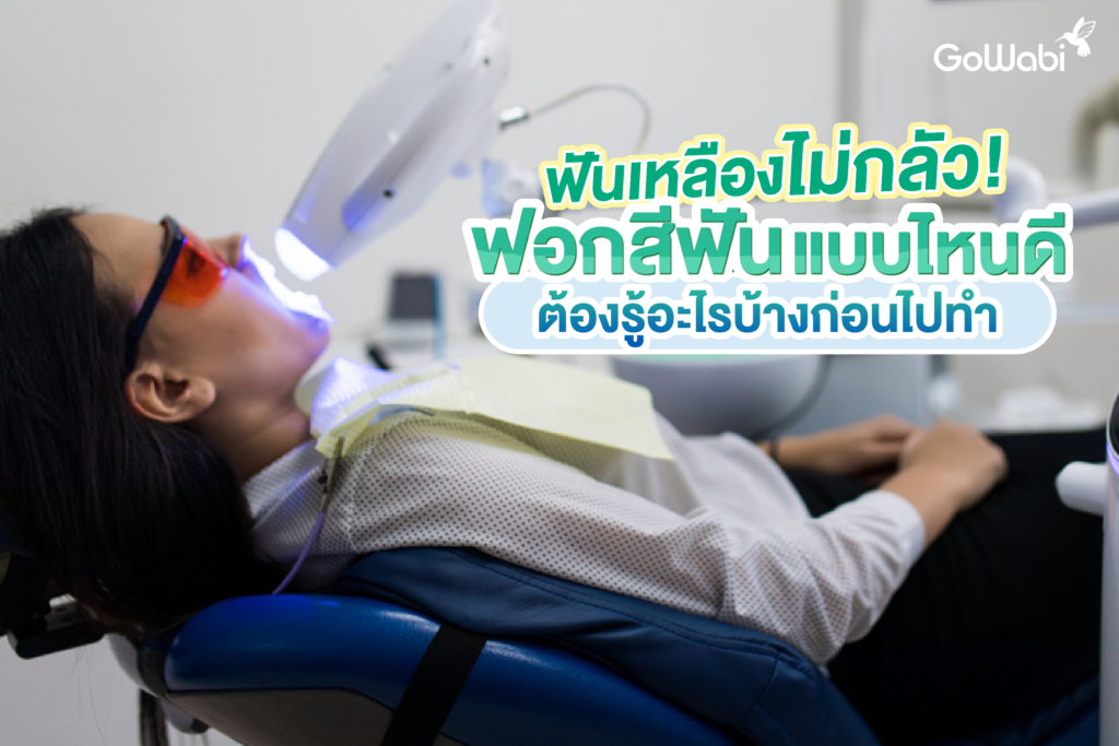 ฟันเหลืองไม่กลัว! ฟอกสีฟันแบบไหนดี ต้องรู้อะไรบ้างก่อนไปทำ