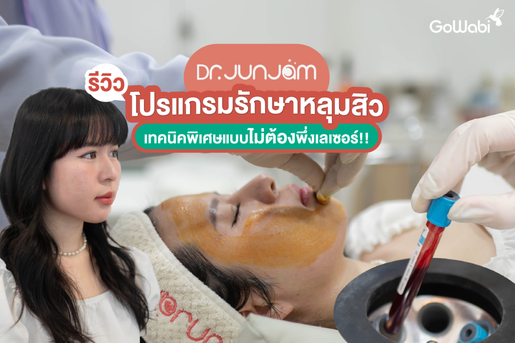 Dr. Junjam Clinic รีวิวโปรแกรมรักษาหลุมสิวเทคนิคพิเศษแบบไม่ต้องพึ่งเลเซอร์!!