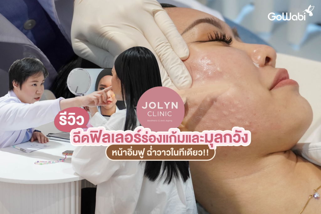 Jolyn Clinic รีวิวฉีดฟิลเลอร์ร่องแก้มและมุลกวัง หน้าอิ่มฟู ฉ่ำวาวในทีเดียว!!