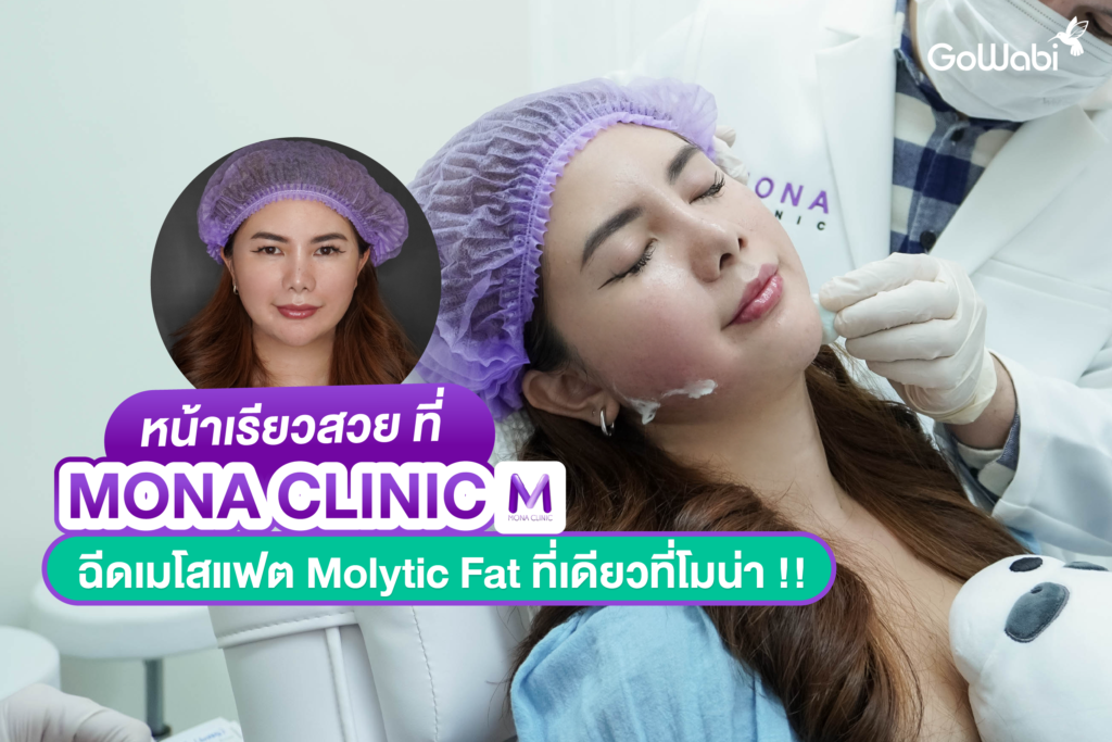 เสกหน้าเรียวสวย ที่ Mona Clinic รีวิวฉีดเมโสแฟต Molytic Fat ที่เดียวที่โมน่า !!