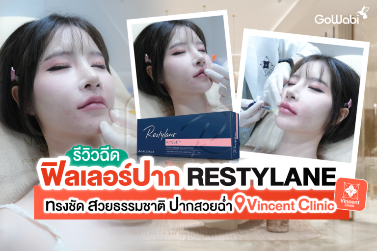 ปากสวยฉ่ำ! Vincent Clinic รีวิวฉีดฟิลเลอร์ปาก Restylane ทรงชัด สวยธรรมชาติ
