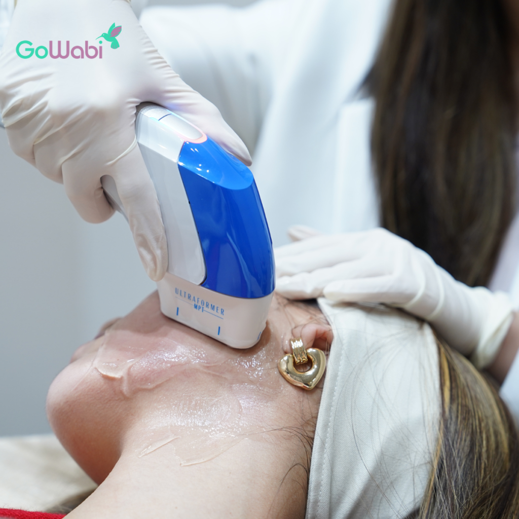 Vincent Clinic รีวิวทำ UltraformerMPT