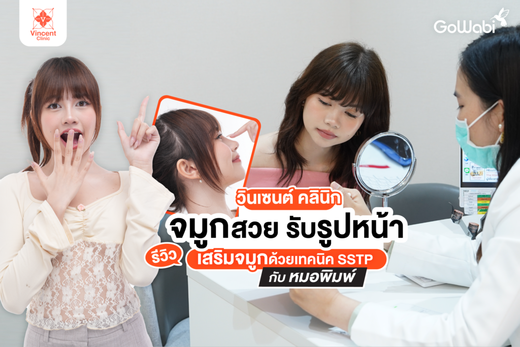 จมูกสวย รับรูปหน้า! ที่ วินเซนต์ คลินิก รีวิวเสริมจมูกด้วยเทคนิค SSTP กับหมอพิมพ์