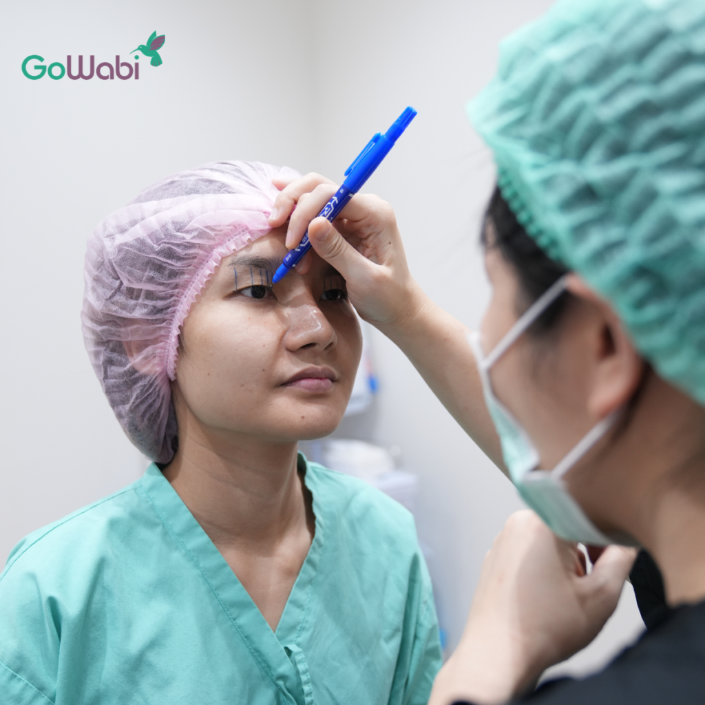 วาดตาสองชั้นก่อนทำ Vincent Clinic รีวิวทำตาสองชั้น