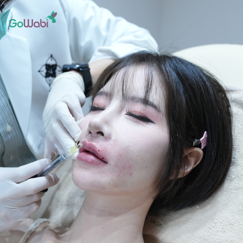 Vincent Clinic รีวิวฉีดฟิลเลอร์ปาก