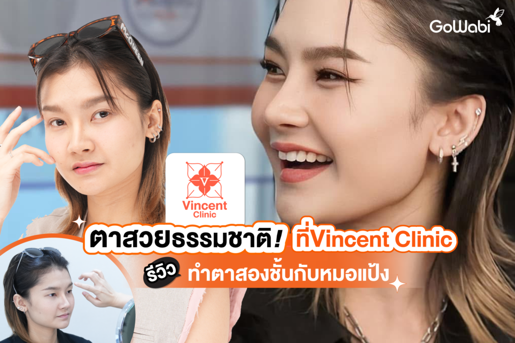 ตาสวยธรรมชาติ! ที่ Vincent Clinic รีวิวทำตาสองชั้นกับหมอแป้ง