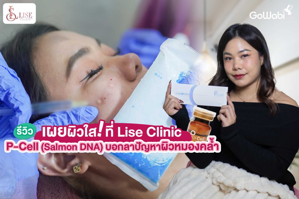 เผยผิวใส! ที่ Lise Clinic รีวิว P-Cell Salmon DNA บอกลาปัญหาผิวหมองคล้ำ