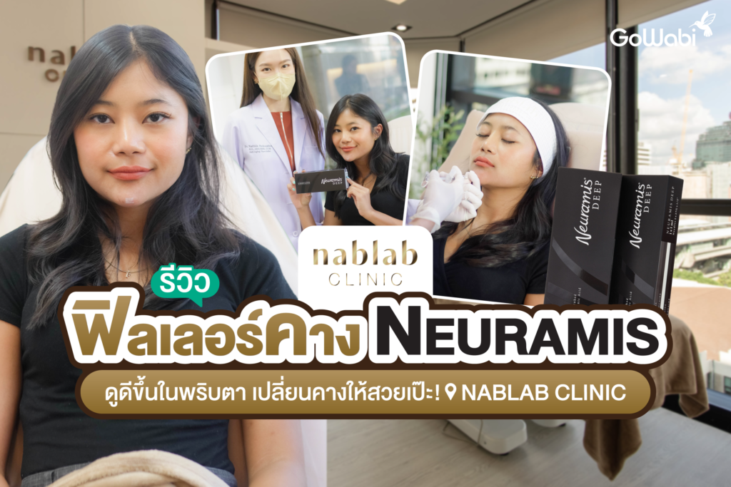 เปลี่ยนคางให้สวยเป๊ะ! Nablab Clinic รีวิวฉีดฟิลเลอร์คาง Neuramis ดูดีขึ้นในพริบตา