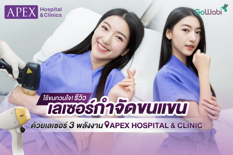 เลเซอร์ขน Apex รีวิวกำจัดขนแขนด้วยเลเซอร์ขน 3 พลังงาน