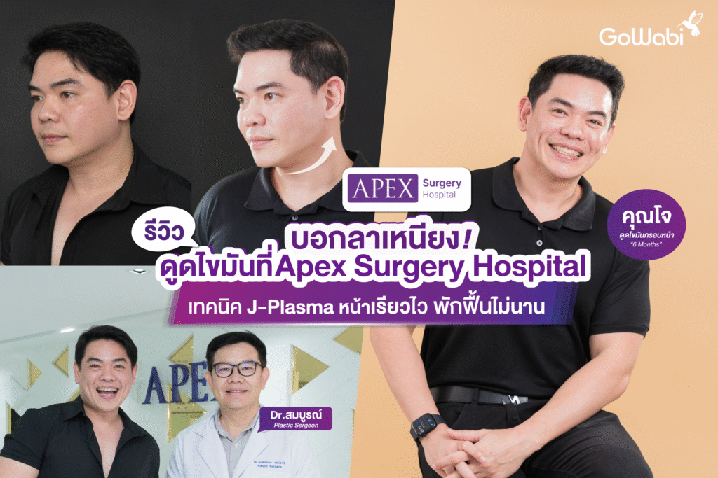 ดูดไขมัน Apex เทคนิค J-plasma รีวิว
